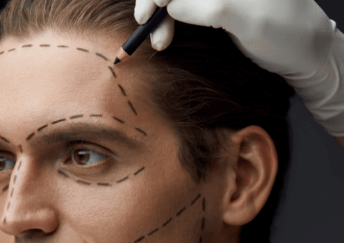Facial surgeries for men
