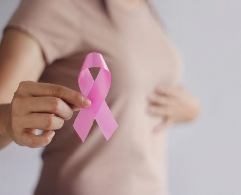 breast reconstruction