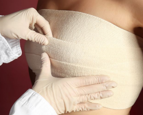 breast reduction recovery