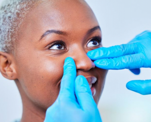 Revision Rhinoplasty