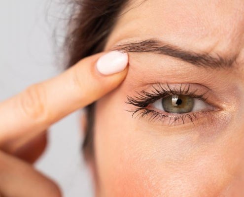 Eyelid Surgery