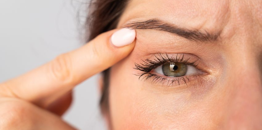 Eyelid Surgery