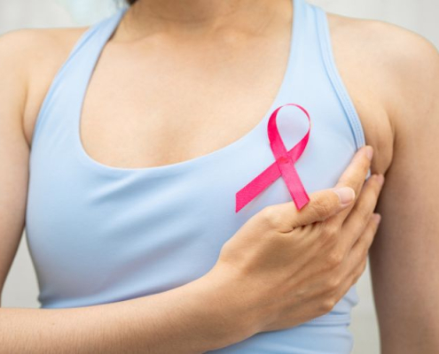 Fat Grafting for Breast Reconstruction
